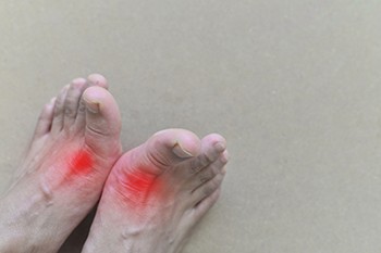 Is Gout Dangerous?